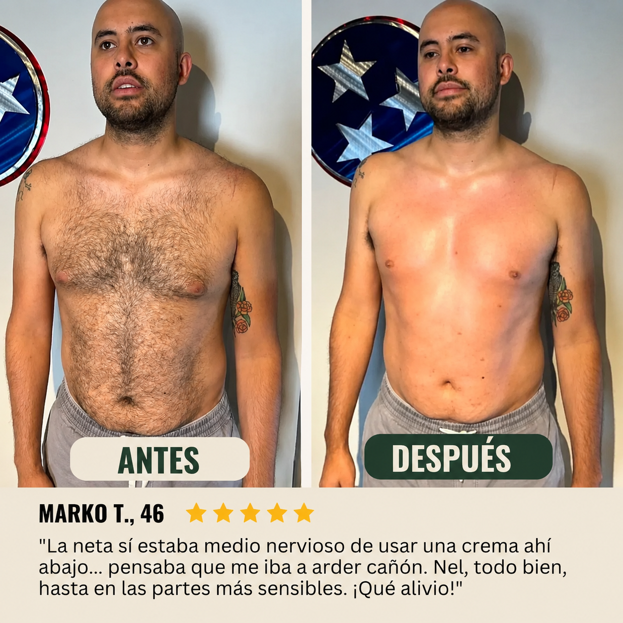 ¿Sigues afeitándote? Podrías estar empeorando las cosas.